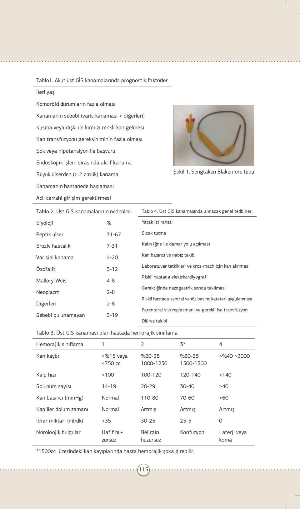 transfüzyonu gereksiniminin fazla olması Şok veya hipotansiyon ile başvuru Endoskopik işlem sırasında aktif kanama Büyük ülserden (> 2 cm lik) kanama Şekil 1.