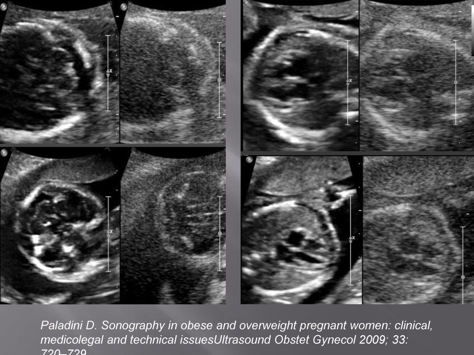 pregnant women: clinical,