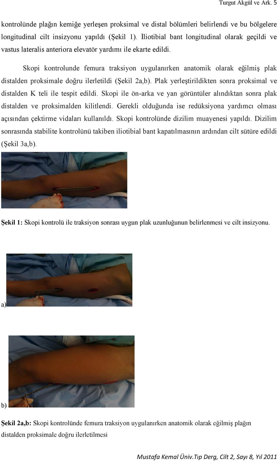 Skopi kontrolunde femura traksiyon uygulanırken anatomik olarak eğilmiş plak distalden proksimale doğru ilerletildi (Şekil 2a,b).