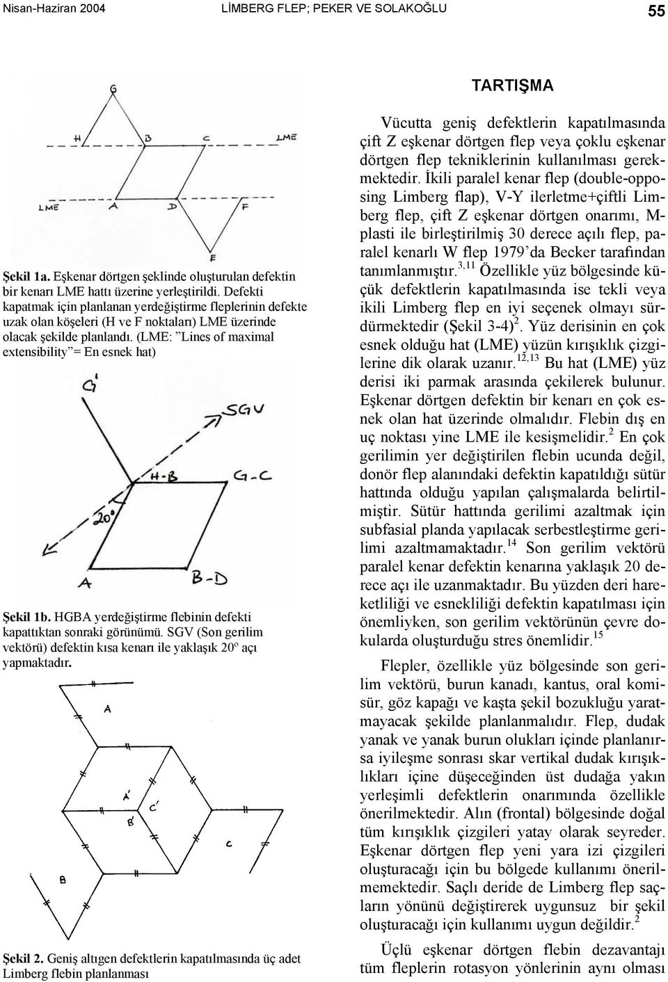 (LME: Lines of maximal extensibility = En esnek hat) Şekil 1b. HGBA yerdeğiştirme flebinin defekti kapattıktan sonraki görünümü.