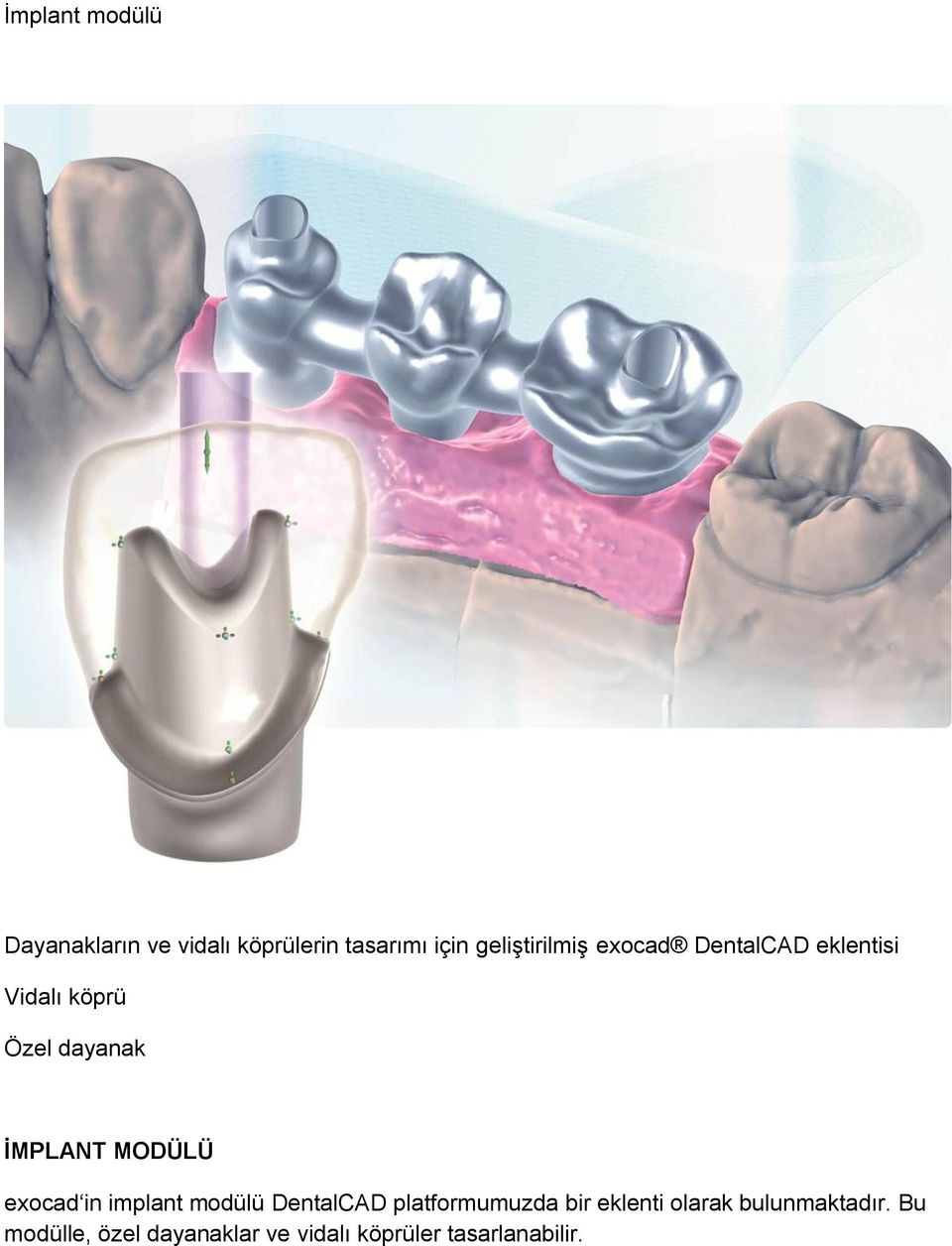 İMPLANT MODÜLÜ exocad in implant modülü DentalCAD platformumuzda bir