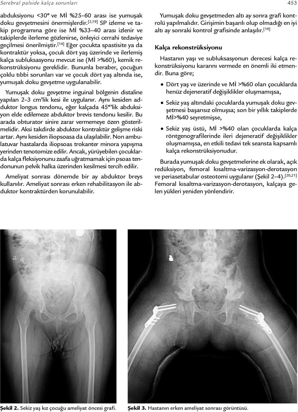 [14] Eğer çocukta spastisite ya da kontraktür yoksa, çocuk dört yaş üzerinde ve ilerlemiş kalça subluksasyonu mevcut ise (Mİ >%60), kemik rekonstrüksiyonu gereklidir.