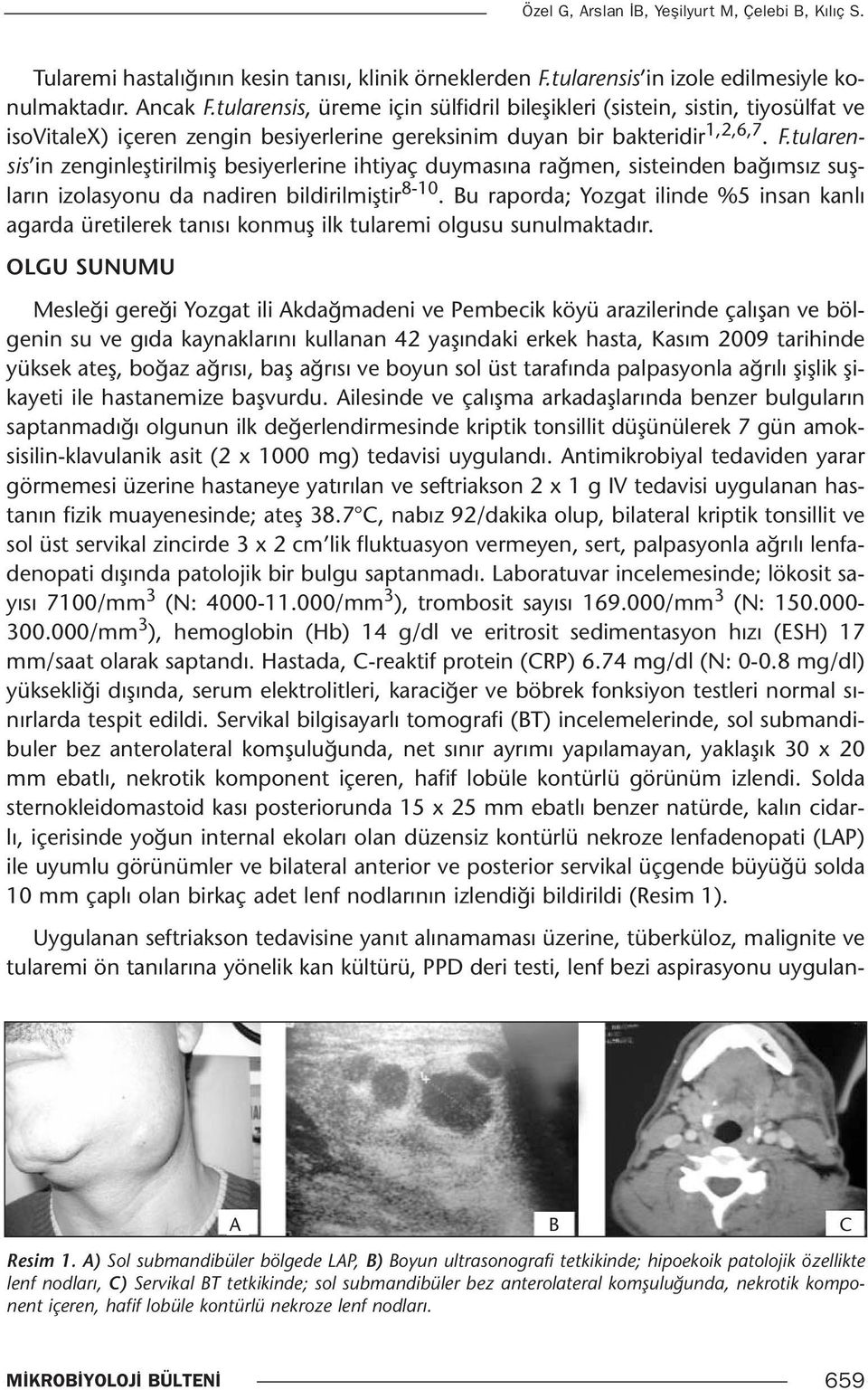 tularensis in zenginleştirilmiş besiyerlerine ihtiyaç duymasına rağmen, sisteinden bağımsız suşların izolasyonu da nadiren bildirilmiştir 8-10.