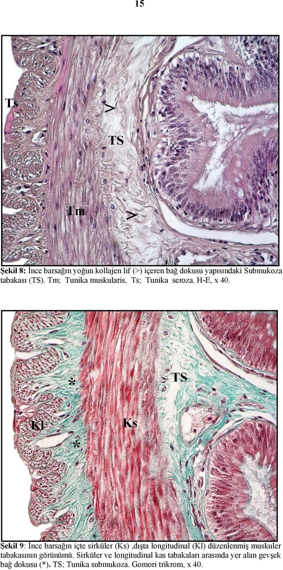 * TS Kl * Ks Şekil 9: İnce barsağın içte sirküler (Ks),dışta longitudinal (Kl) düzenlenmiş muskuler