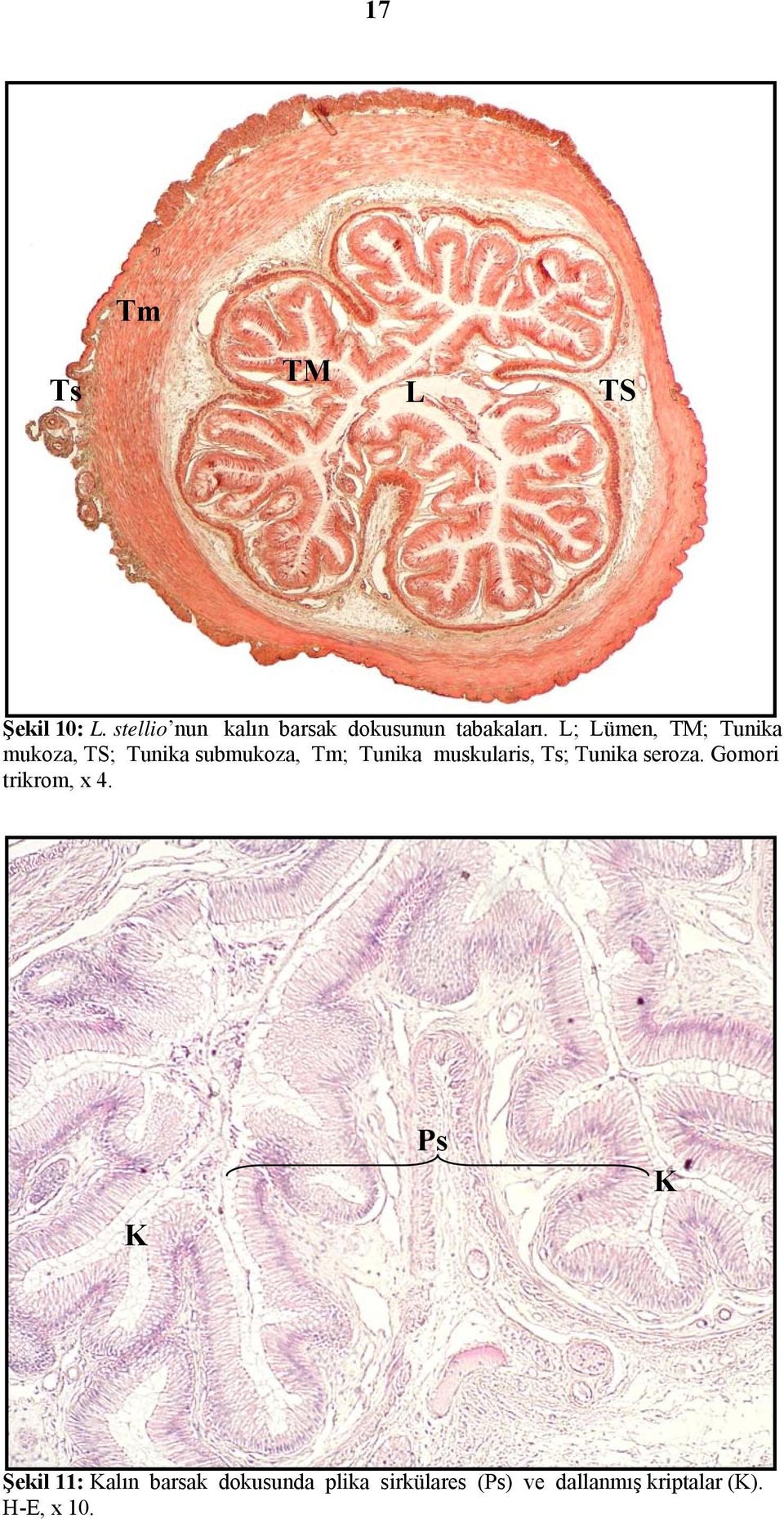 L; Lümen, TM; Tunika mukoza, TS; Tunika submukoza, Tm; Tunika