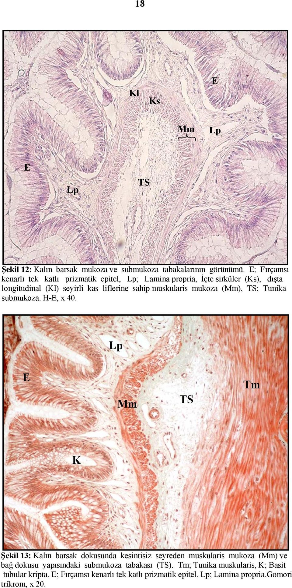 muskularis mukoza (Mm), TS; Tunika submukoza. H-E, x 40.