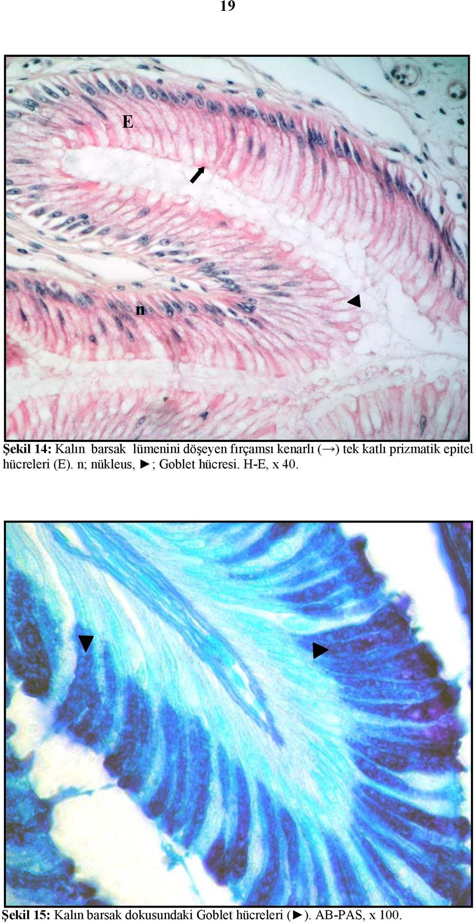 n; nükleus, ; Goblet hücresi. H-E, x 40.