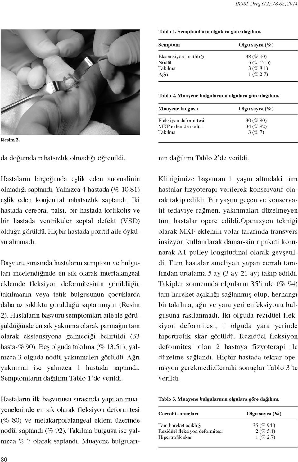 Hastaların ilk başvurusu sırasında yapılan muayenelerinde en sık olarak fleksiyon deformitesi (% 80) ve metakarpofalangeal eklem üzerinde nodül saptandı (% 92).