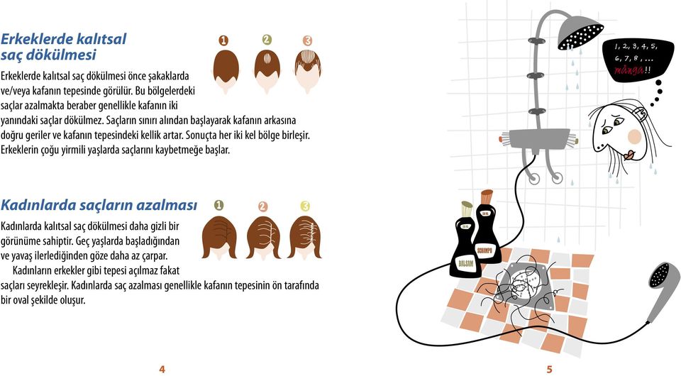 Saçların sınırı alından başlayarak kafanın arkasına doğru geriler ve kafanın tepesindeki kellik artar. Sonuçta her iki kel bölge birleşir.