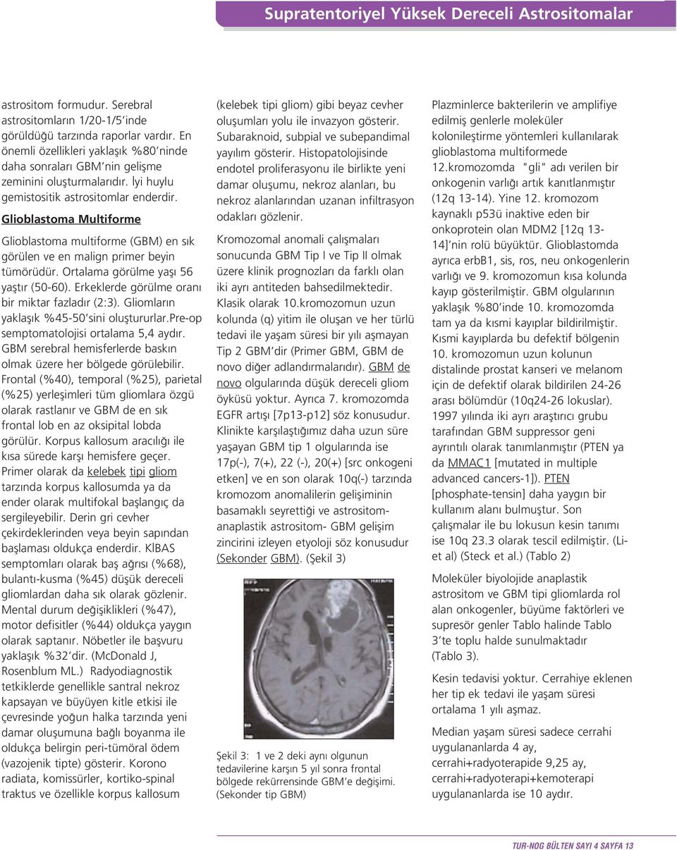 Glioblastoma Multiforme Glioblastoma multiforme (GBM) en s k görülen ve en malign primer beyin tümörüdür. Ortalama görülme yafl 56 yaflt r (50-60). Erkeklerde görülme oran bir miktar fazlad r (2:3).