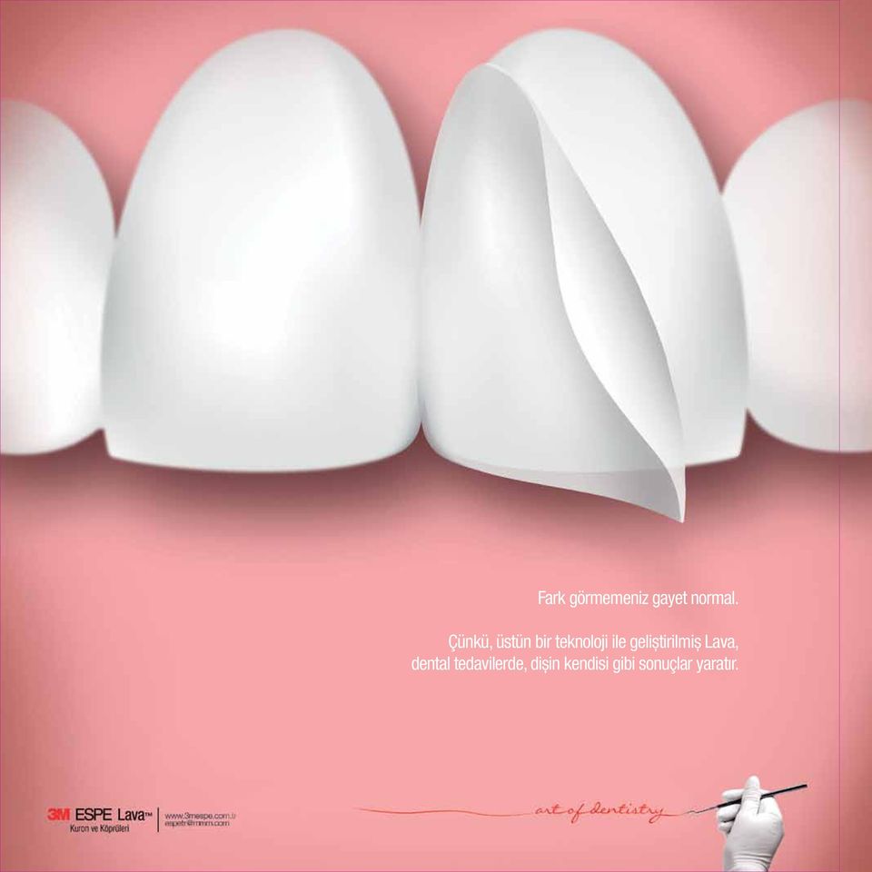 geliştirilmiş Lava, dental