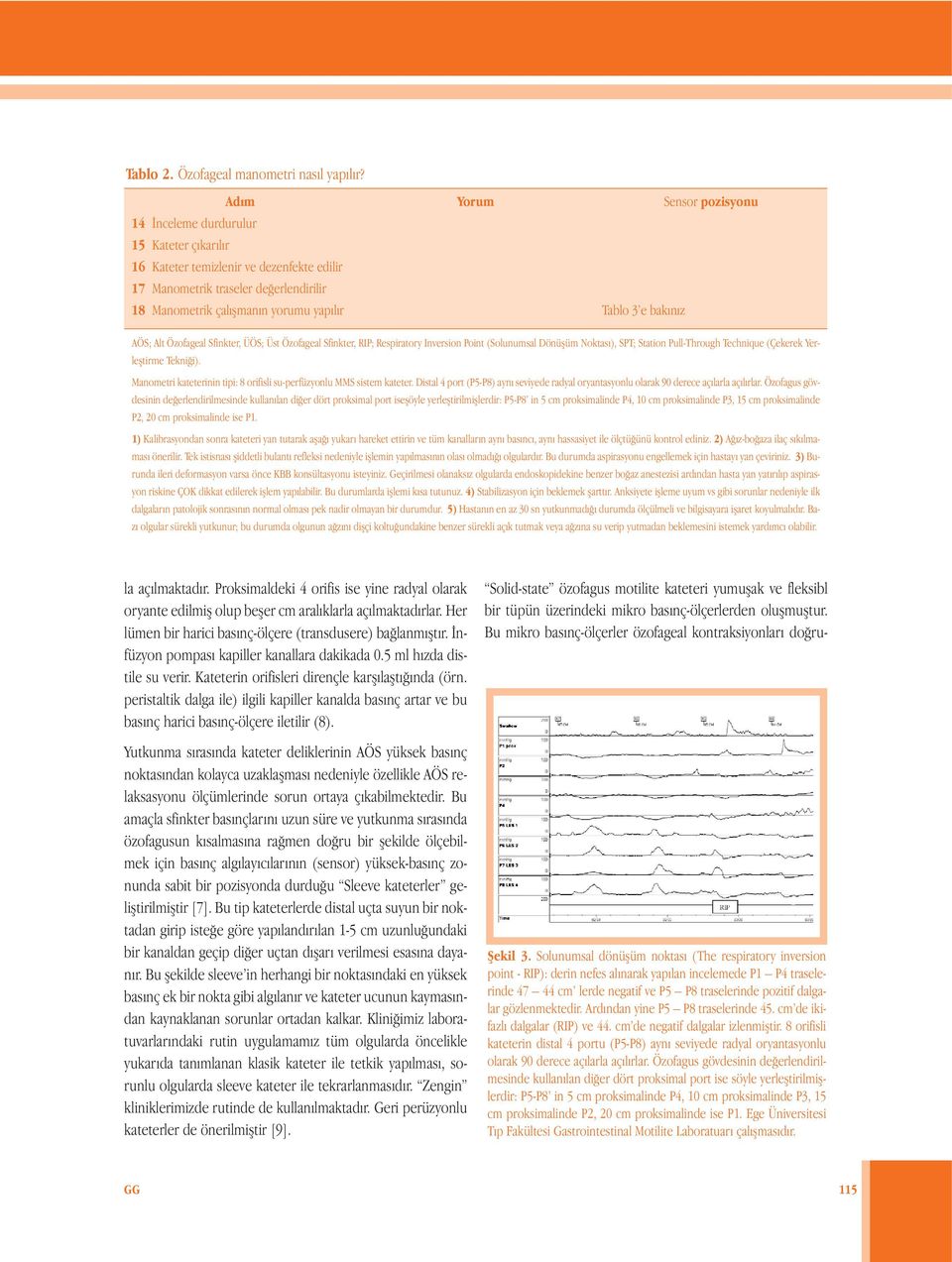 Sensor pozisyonu AÖS; Alt Özofageal Sfinkter, ÜÖS; Üst Özofageal Sfinkter, RIP; Respiratory Inversion Point (Solunumsal Dönüşüm Noktası), SPT; Station Pull-Through Technique (Çekerek Yerleştirme