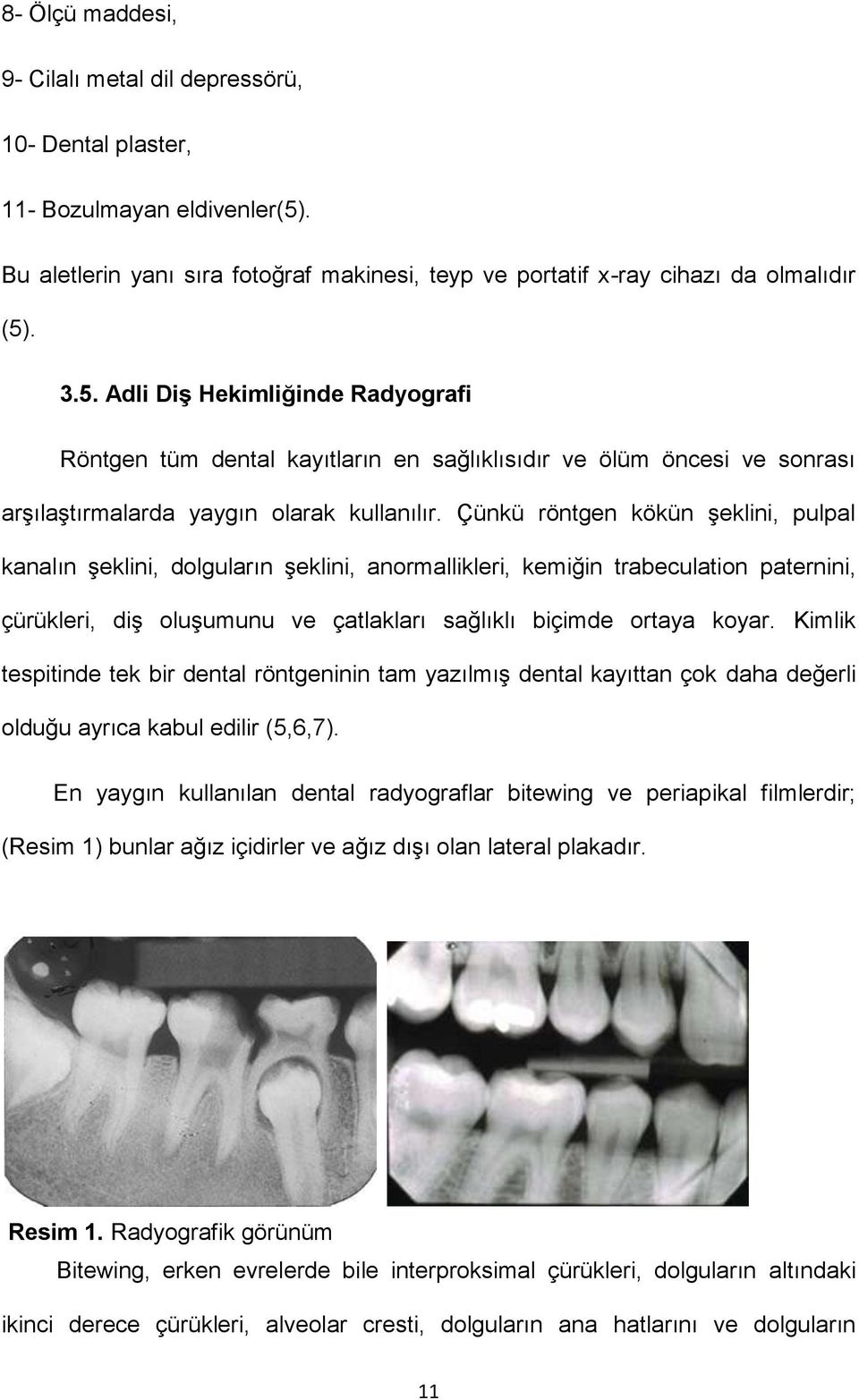 . 3.5. Adli Diş Hekimliğinde Radyografi Röntgen tüm dental kayıtların en sağlıklısıdır ve ölüm öncesi ve sonrası arşılaştırmalarda yaygın olarak kullanılır.