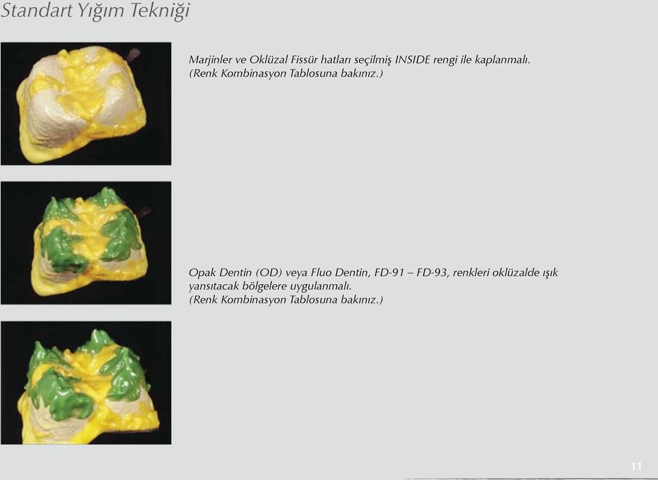 ) Opak Dentin (OD) veya Fluo Dentin, FD-91 FD-93, renkleri oklüzalde