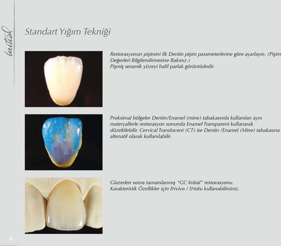 Proksimal bölgeler Dentin/Enamel (mine) tabakasında kullanılan aynı materyallerle restorasyon sonunda Enamel Transparent kullanarak