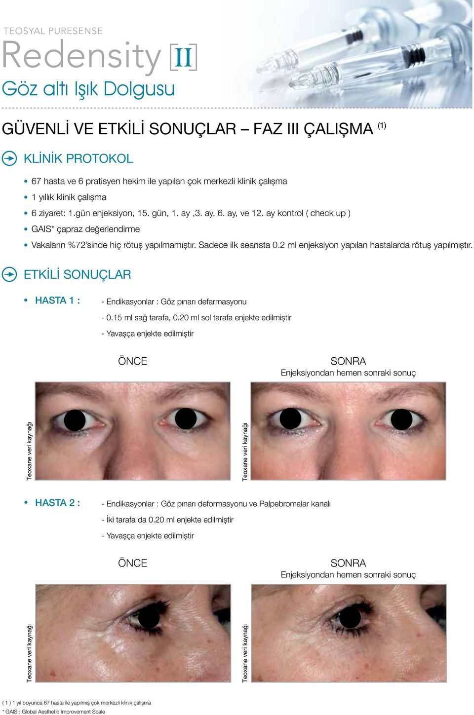 ETKİLİ SONUÇLAR HASTA 1 : - Endikasyonlar : Göz pınarı defarmasyonu - 0.15 ml sağ tarafa, 0.