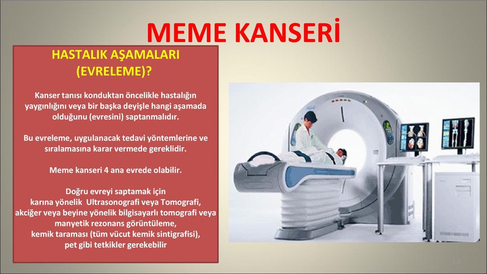 Bu evreleme, uygulanacak tedavi yöntemlerine ve sıralamasına karar vermede gereklidir. Meme kanseri 4 ana evrede olabilir.