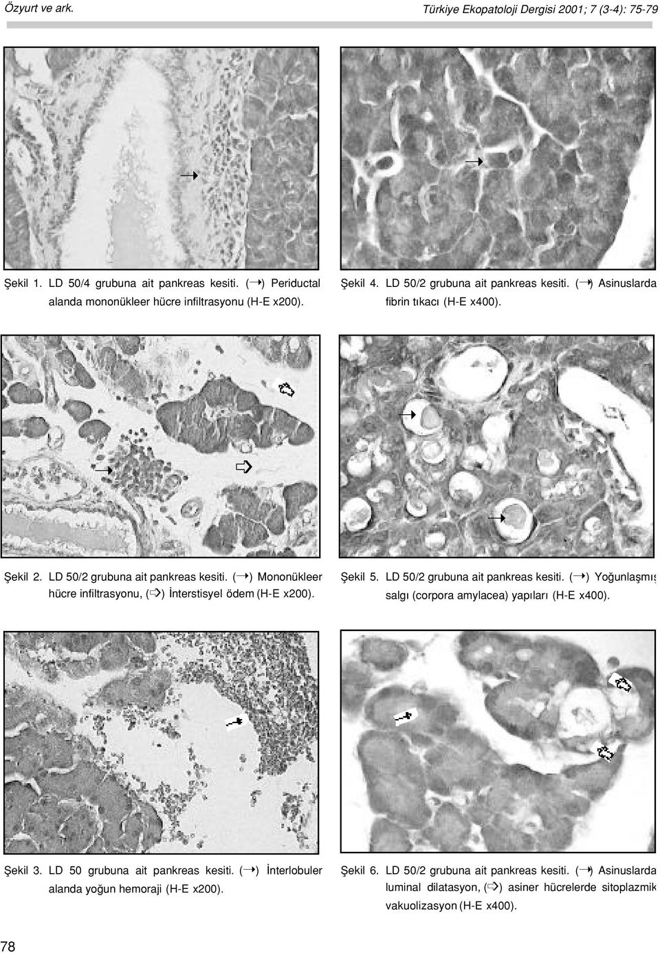 fiekil 5. LD 50/2 grubuna ait pankreas kesiti. ( ) Yo unlaflm fl salg (corpora amylacea) yap lar (H-E x400). fiekil 3. LD 50 grubuna ait pankreas kesiti.