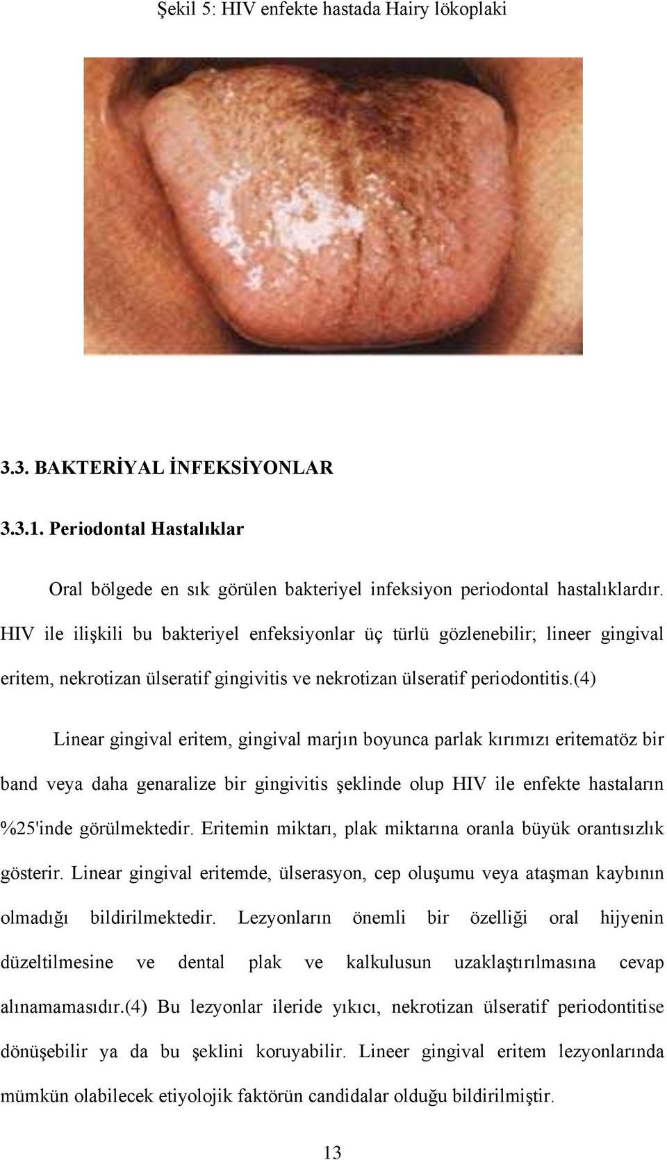 (4) Linear gingival eritem, gingival marjın boyunca parlak kırımızı eritematöz bir band veya daha genaralize bir gingivitis şeklinde olup HIV ile enfekte hastaların %25'inde görülmektedir.