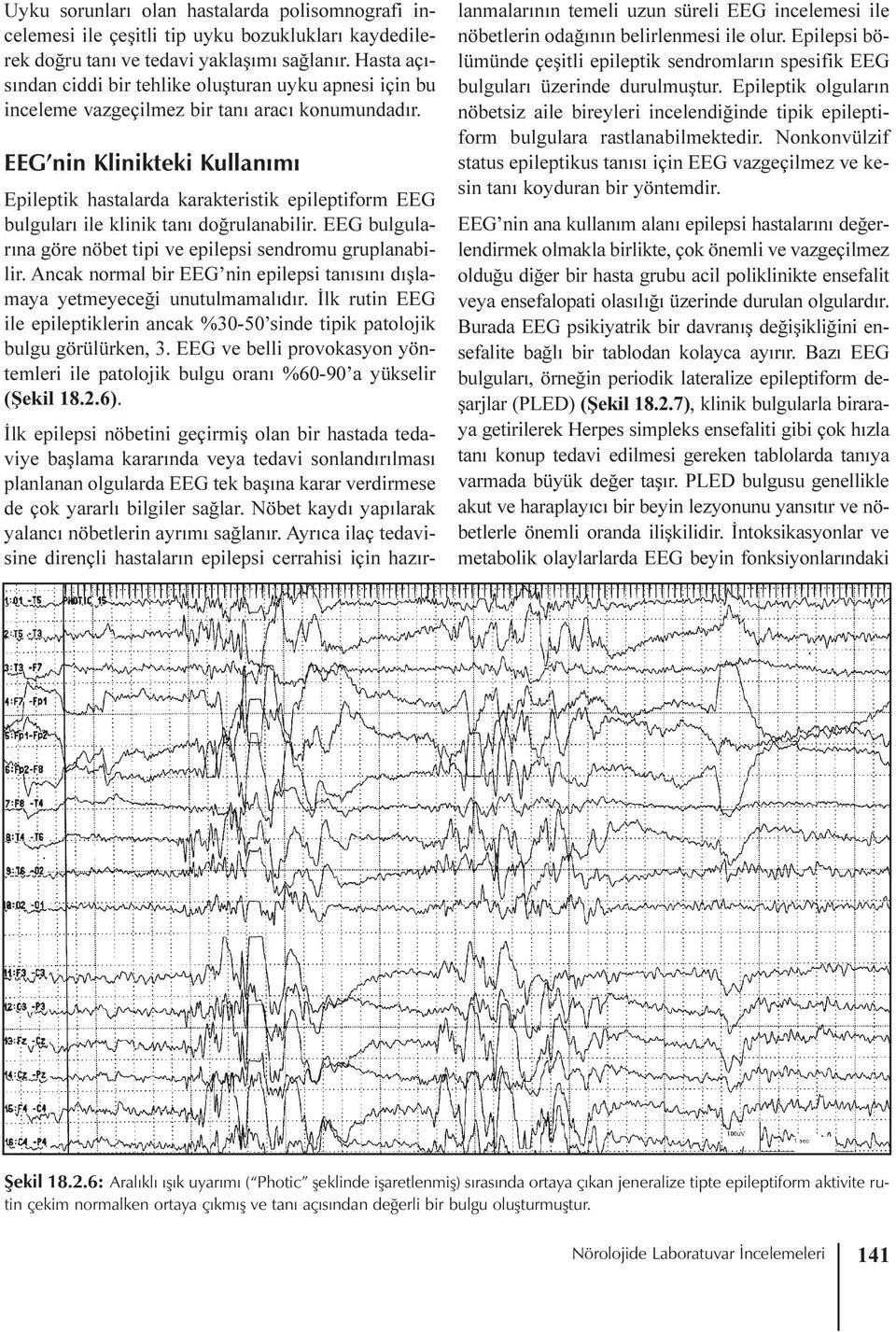 EEG nin Klinikteki Kullanýmý Epileptik hastalarda karakteristik epileptiform EEG bulgularý ile klinik taný doðrulanabilir. EEG bulgularýna göre nöbet tipi ve epilepsi sendromu gruplanabilir.