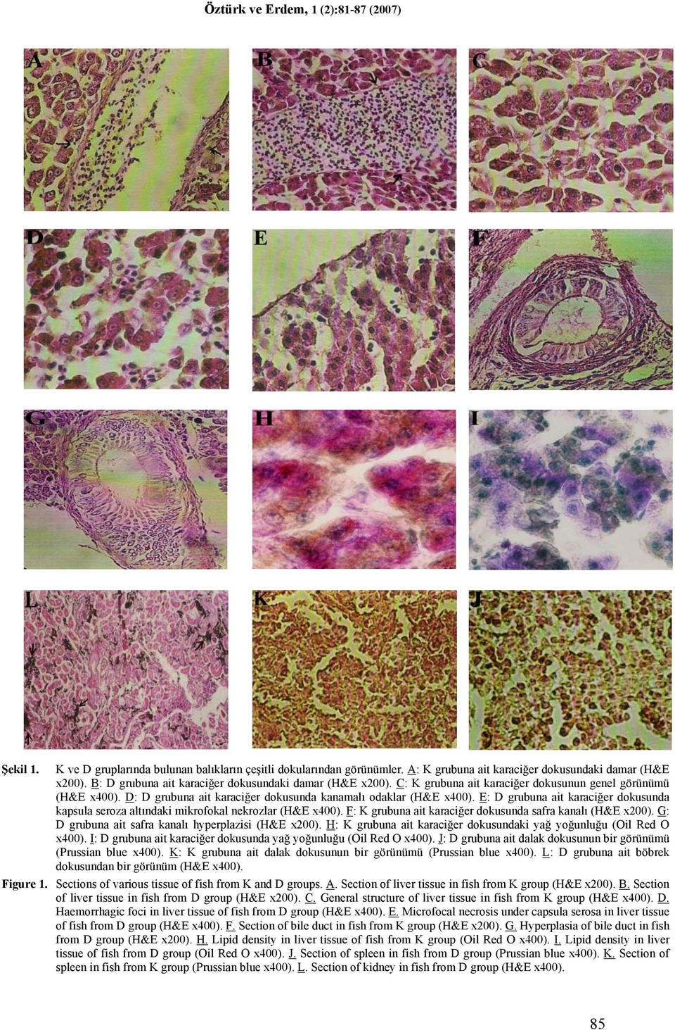 E: D grubuna ait karaciğer dokusunda kapsula seroza altındaki mikrofokal nekrozlar (H&E x400). F: K grubuna ait karaciğer dokusunda safra kanalı (H&E x200).