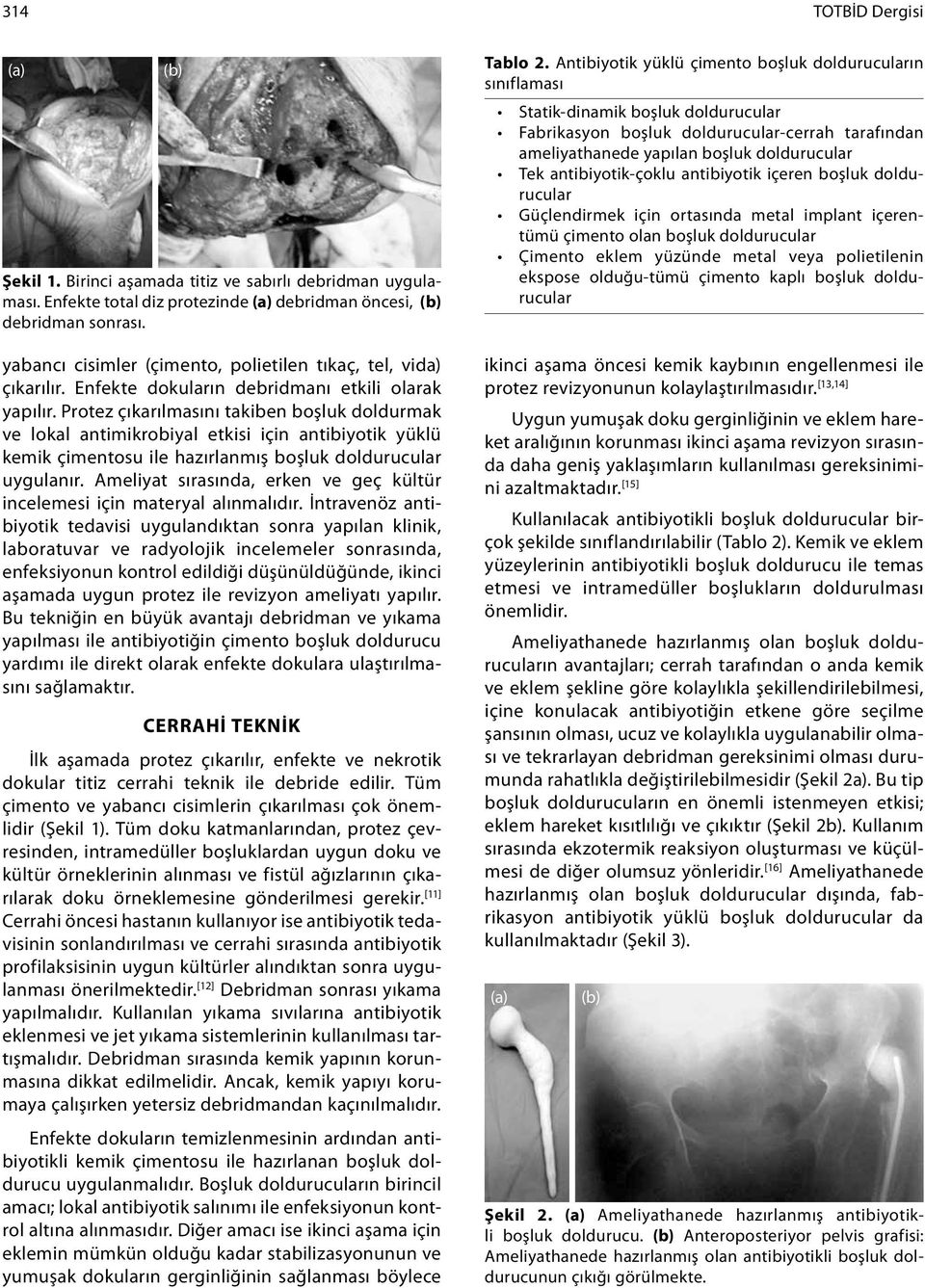 Protez çıkarılmasını takiben boşluk doldurmak ve lokal antimikrobiyal etkisi için antibiyotik yüklü kemik çimentosu ile hazırlanmış boşluk doldurucular uygulanır.