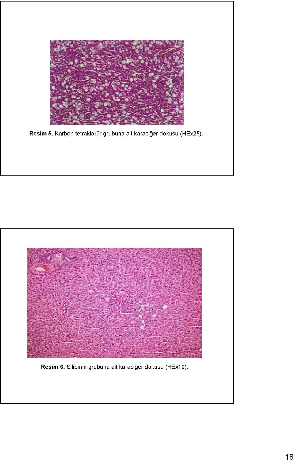karaciğer dokusu (HEx25).