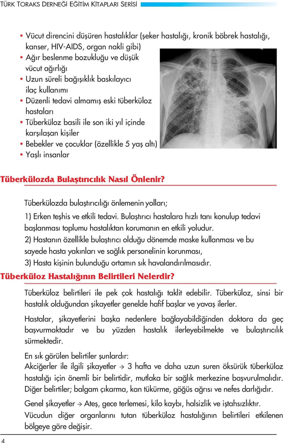 5 yaş altı) Yaşlı insanlar Tüberkülozda Bulaflt r c l k Nas l Önlenir? Tüberkülozda bulaflt r c l önlemenin yollar ; 1) Erken teşhis ve etkili tedavi.