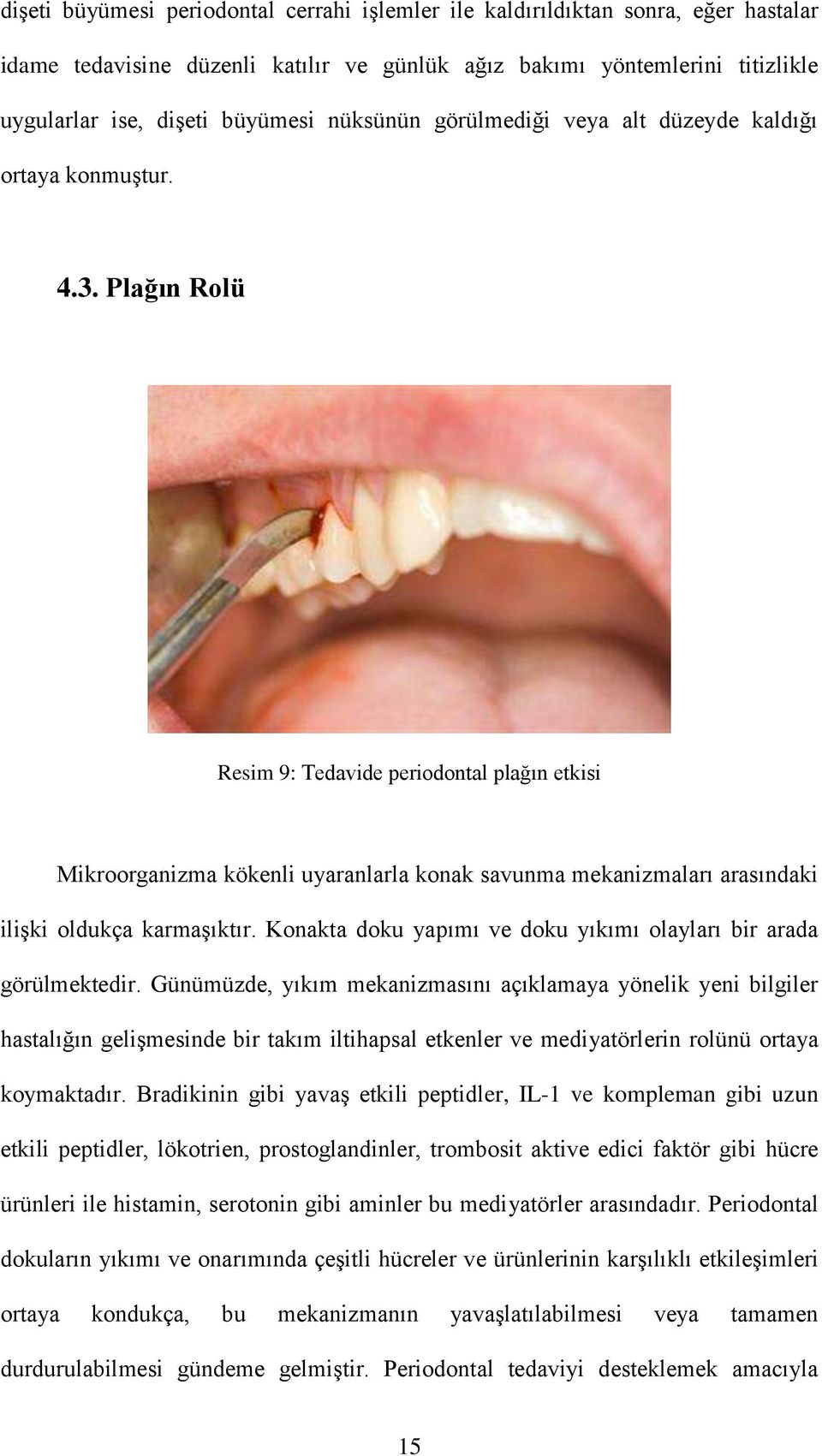 Plağın Rolü Resim 9: Tedavide periodontal plağın etkisi Mikroorganizma kökenli uyaranlarla konak savunma mekanizmaları arasındaki ilişki oldukça karmaşıktır.