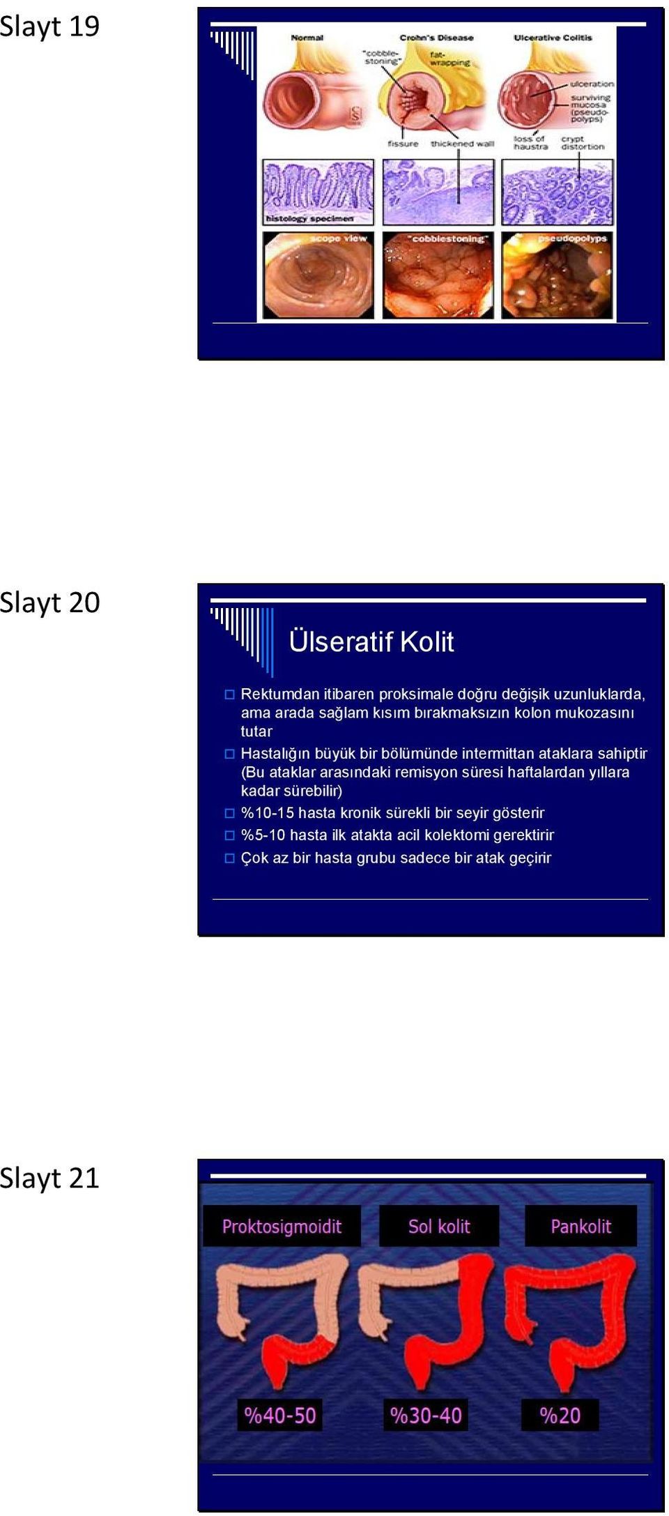 ataklar arasındaki remisyon süresi haftalardan yıllara kadar sürebilir) %10-15 hasta kronik sürekli bir seyir