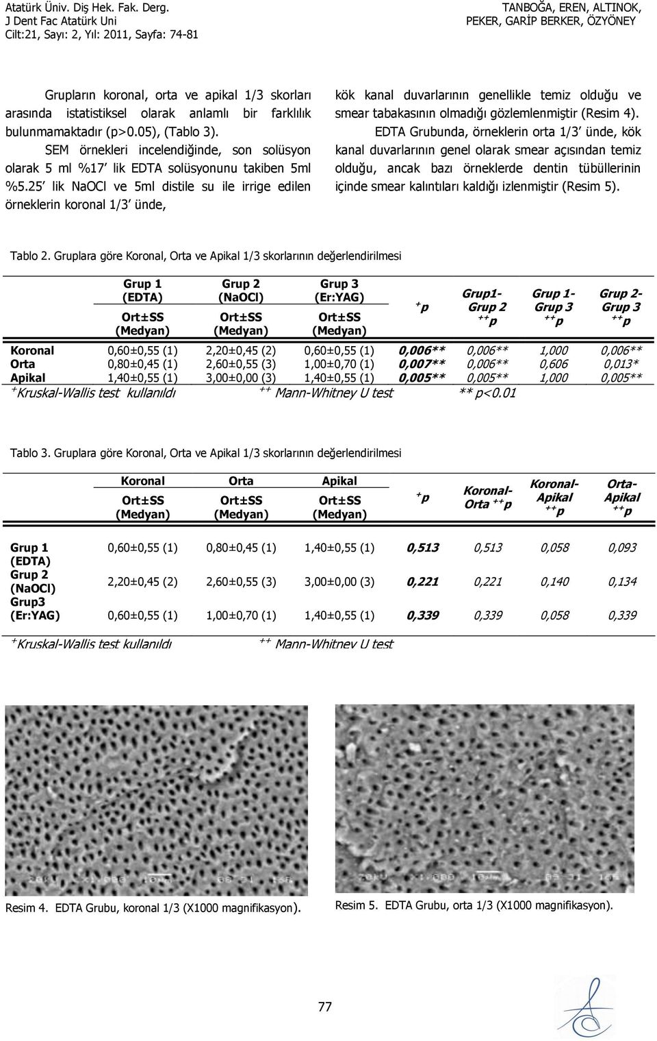 25 lik NaOCl ve 5ml distile su ile irrige edilen örneklerin koronal 1/3 ünde, kök kanal duvarlarının genellikle temiz olduğu ve smear tabakasının olmadığı gözlemlenmiştir (Resim 4).