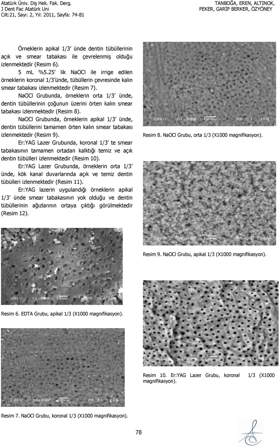 NaOCl Grubunda, örneklerin orta 1/3 ünde, dentin tübüllerinin çoğunun üzerini örten kalın smear tabakası izlenmektedir (Resim 8).