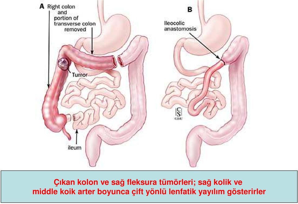 middle koik arter boyunca