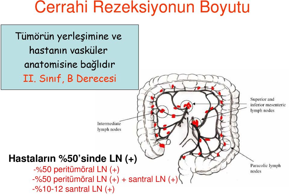 Sınıf, B Derecesi Hastaların %50 sinde LN (+) -%50