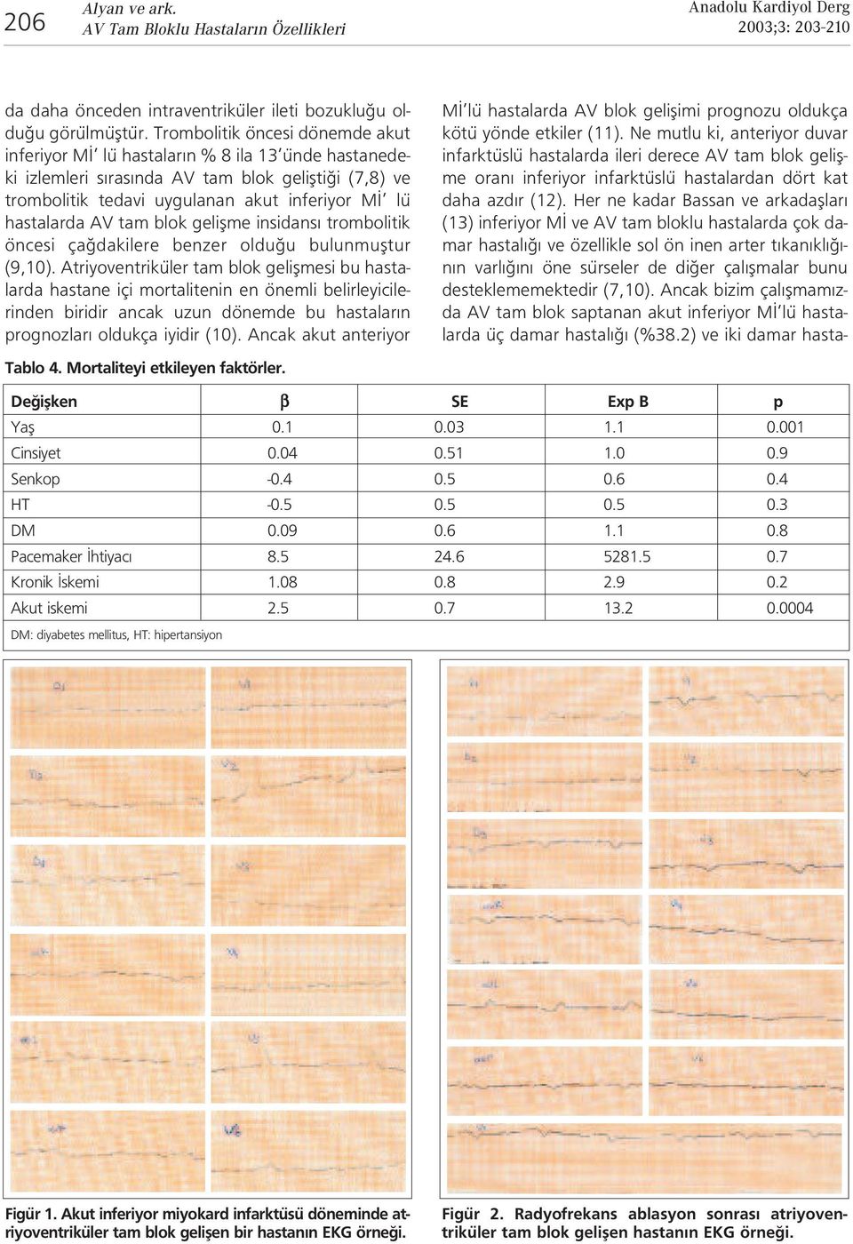 AV tam blok geliflme insidans trombolitik öncesi ça dakilere benzer oldu u bulunmufltur (9,10).