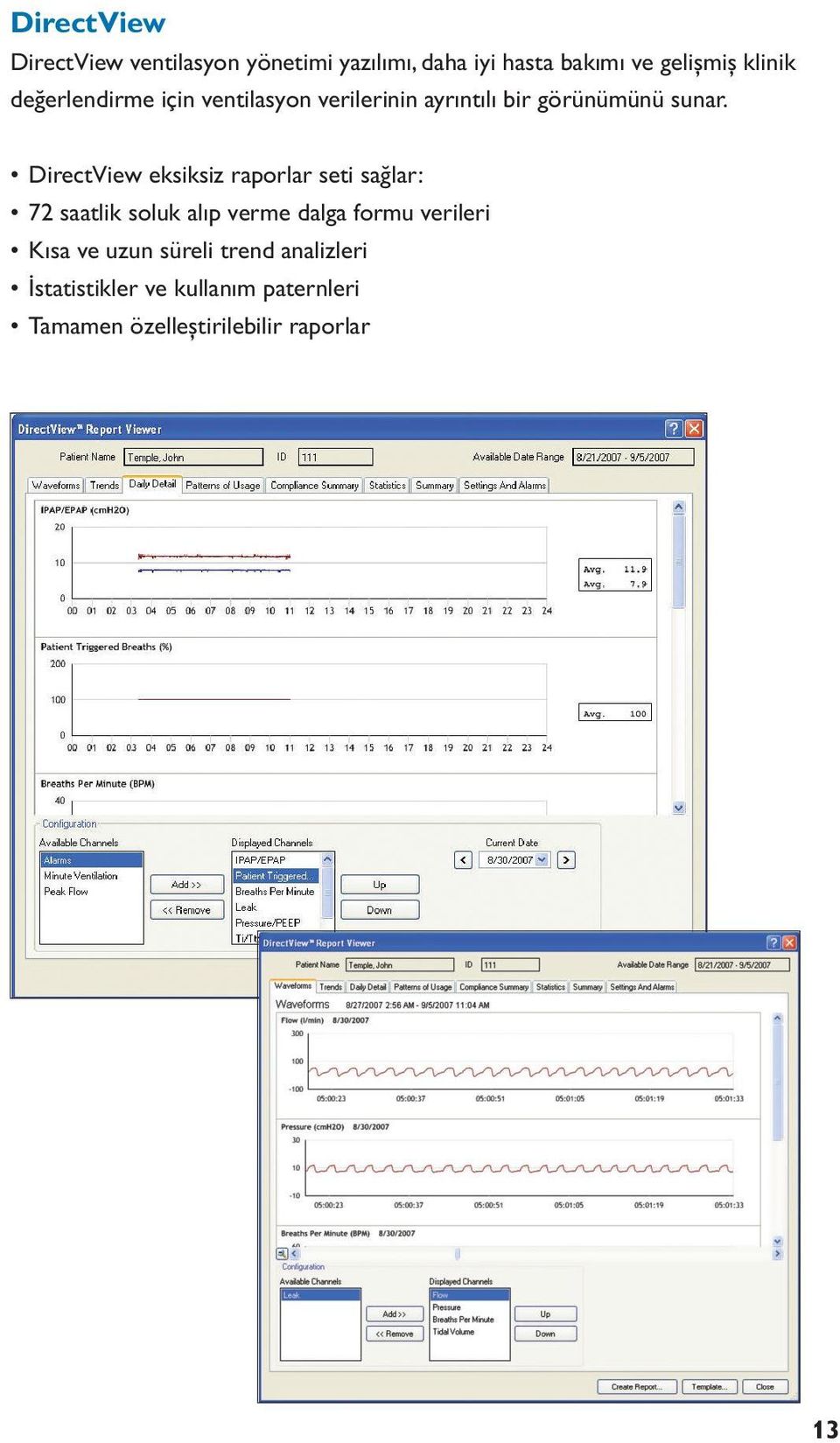 DirectView eksiksiz raporlar seti sağlar: 72 saatlik soluk alıp verme dalga formu verileri