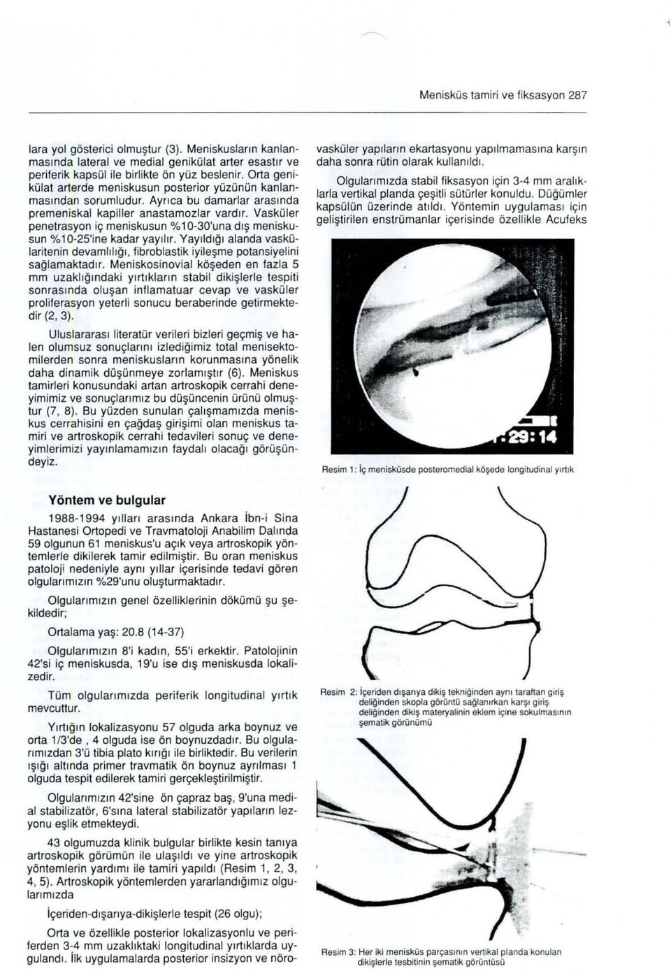 Vasküler penetrasyon iç meniskusun % 10-30'una dış meniskusun % 10-25'ine kadar yayılır. Yayıldığı alanda vaskülaritenin devamlılığı, fibroblastik iyileşme potansiyelini sağlamaktadır.