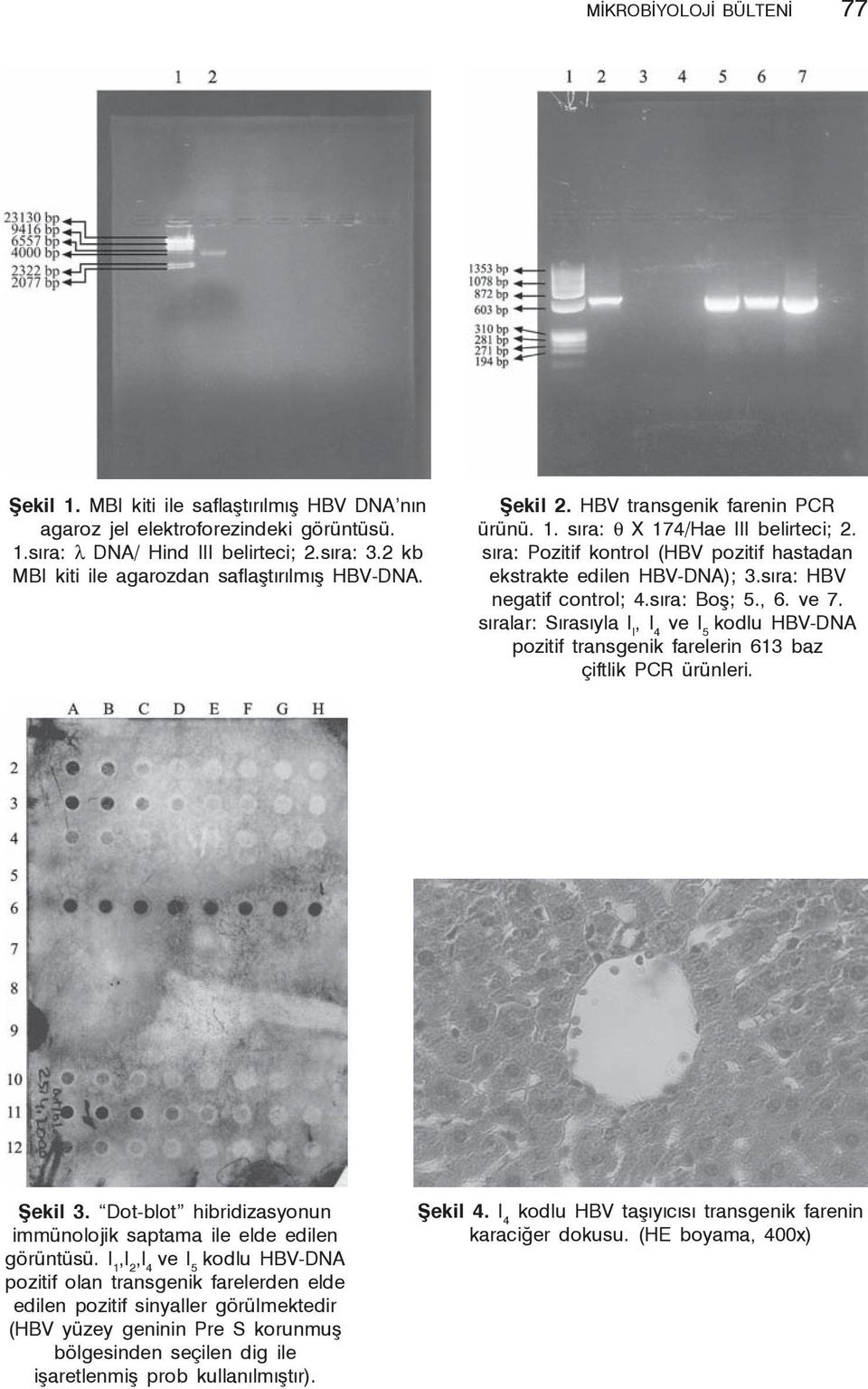 sıra: Pozitif kontrol (HBV pozitif hastadan ekstrakte edilen HBV-DNA); 3.sıra: HBV negatif control; 4.sıra: Boş; 5., 6. ve 7.