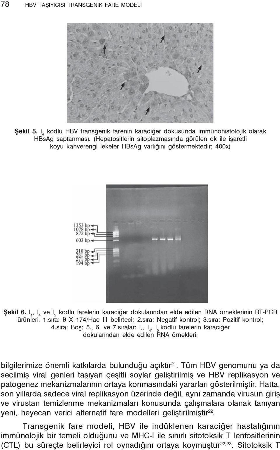 I 1, I 4 ve I 5 kodlu farelerin karaciğer dokularından elde edilen RNA örneklerinin RT-PCR ürünleri. 1.sıra: θ X 174/Hae III belirteci; 2.sıra: Negatif kontrol; 3.sıra: Pozitif kontrol; 4.