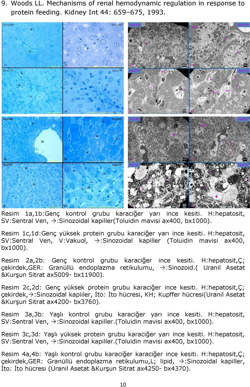 H:hepatosit, SV:Sentral Ven, V:Vakuol, :Sinozoidal kapiller (Toluidin mavisi ax400, bx1000). Resim 2a,2b: Genç kontrol grubu karaciğer ince kesiti.