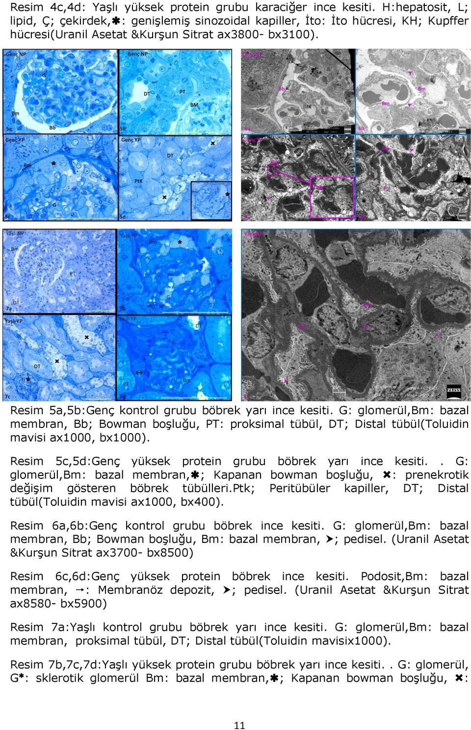 Resim 5a,5b:Genç kontrol grubu böbrek yarı ince kesiti. G: glomerül,bm: bazal membran, Bb; Bowman boşluğu, PT: proksimal tübül, DT; Distal tübül(toluidin mavisi ax1000, bx1000).