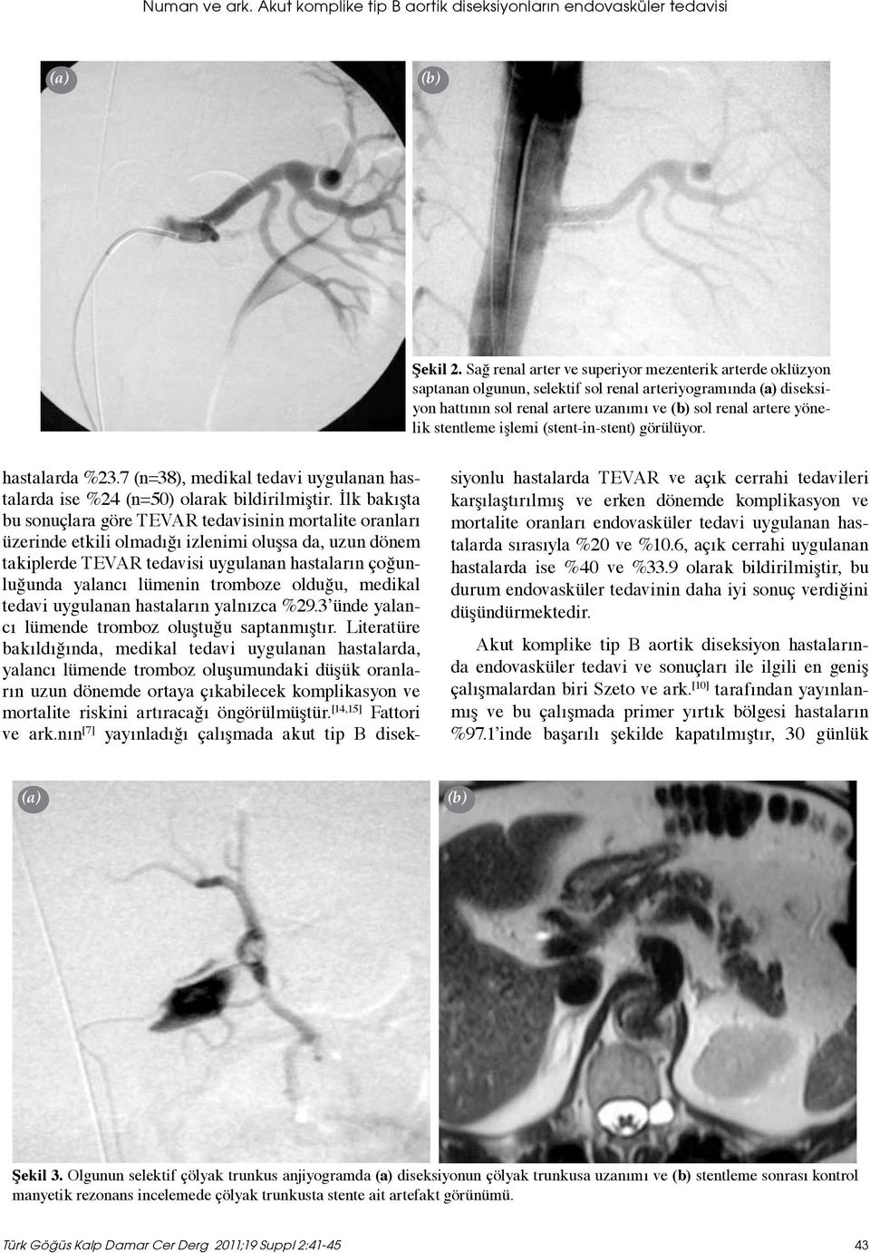 işlemi (stent-in-stent) görülüyor. hastalarda %23.7 (n=38), medikal tedavi uygulanan hastalarda ise %24 (n=50) olarak bildirilmiştir.