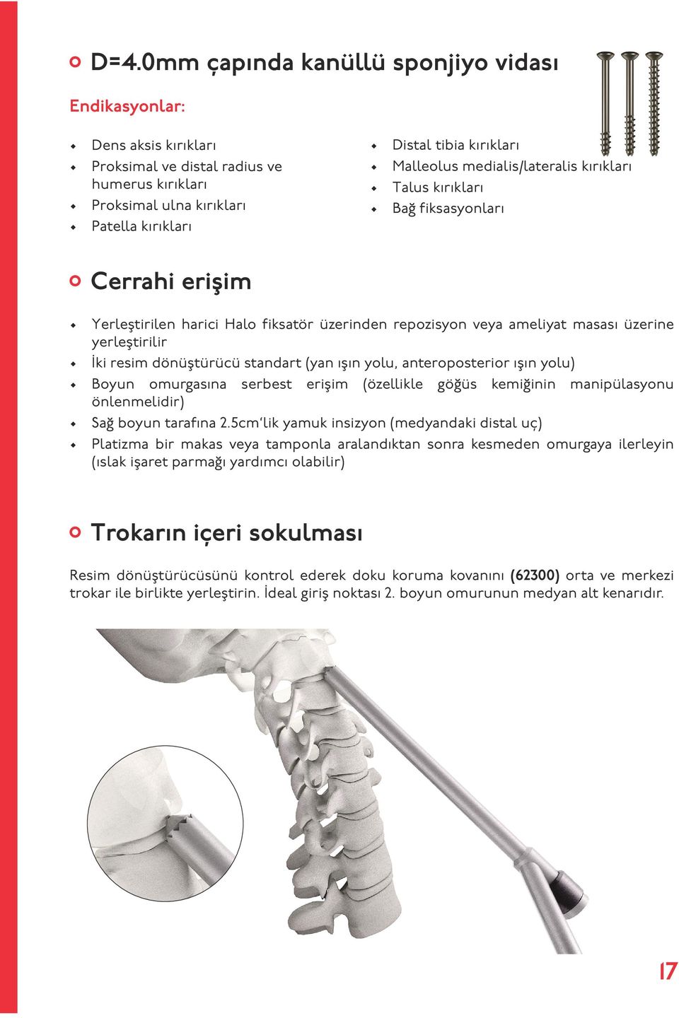 standart (yan ışın yolu, anteroposterior ışın yolu) Boyun omurgasına serbest erişim (özellikle göğüs kemiğinin manipülasyonu önlenmelidir) Sağ boyun tarafına 2.