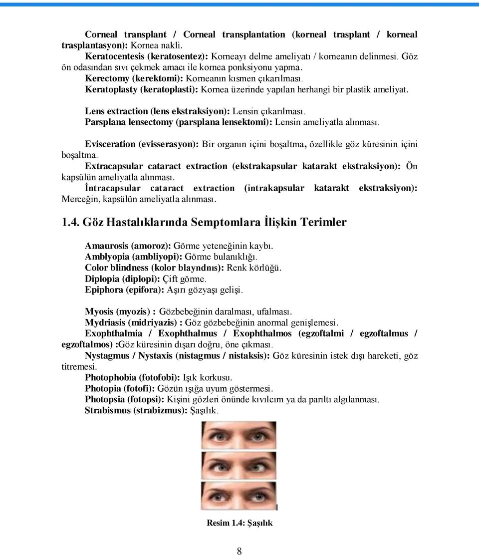 Lens extraction (lens ekstraksiyon): Lensin çıkarılması. Parsplana lensectomy (parsplana lensektomi): Lensin ameliyatla alınması.