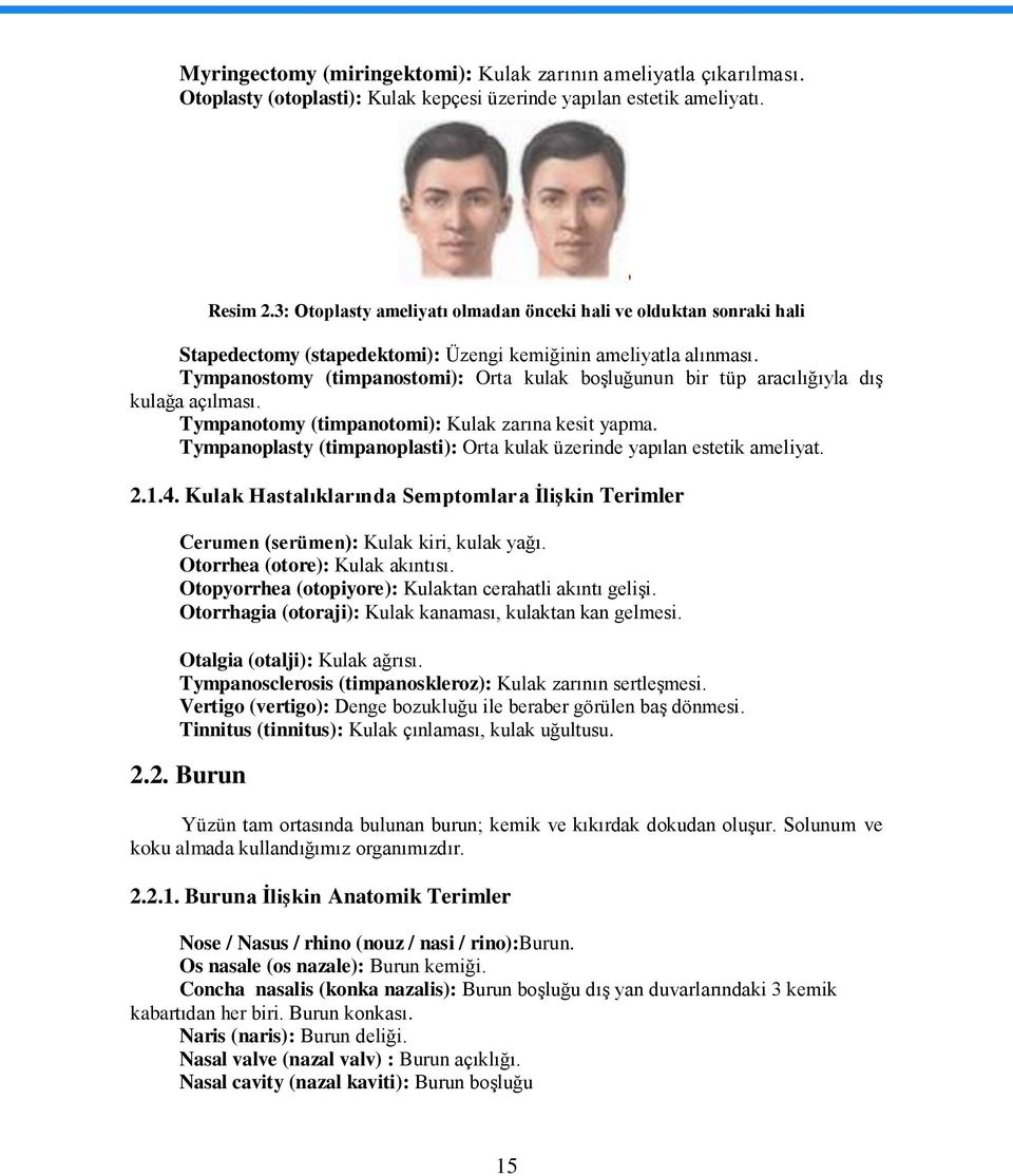 Tympanostomy (timpanostomi): Orta kulak boģluğunun bir tüp aracılığıyla dıģ kulağa açılması. Tympanotomy (timpanotomi): Kulak zarına kesit yapma.