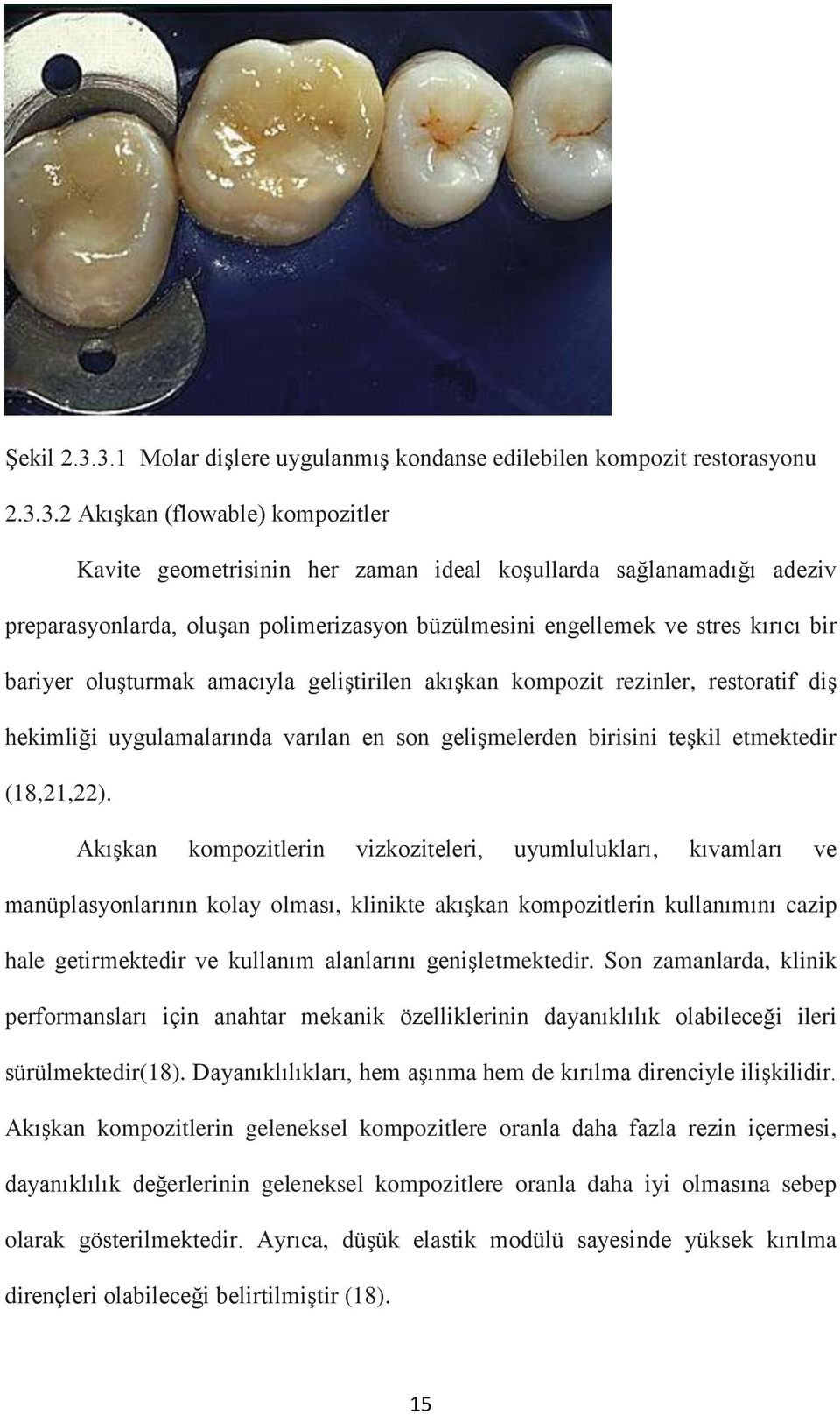 oluşan polimerizasyon büzülmesini engellemek ve stres kırıcı bir bariyer oluşturmak amacıyla geliştirilen akışkan kompozit rezinler, restoratif diş hekimliği uygulamalarında varılan en son