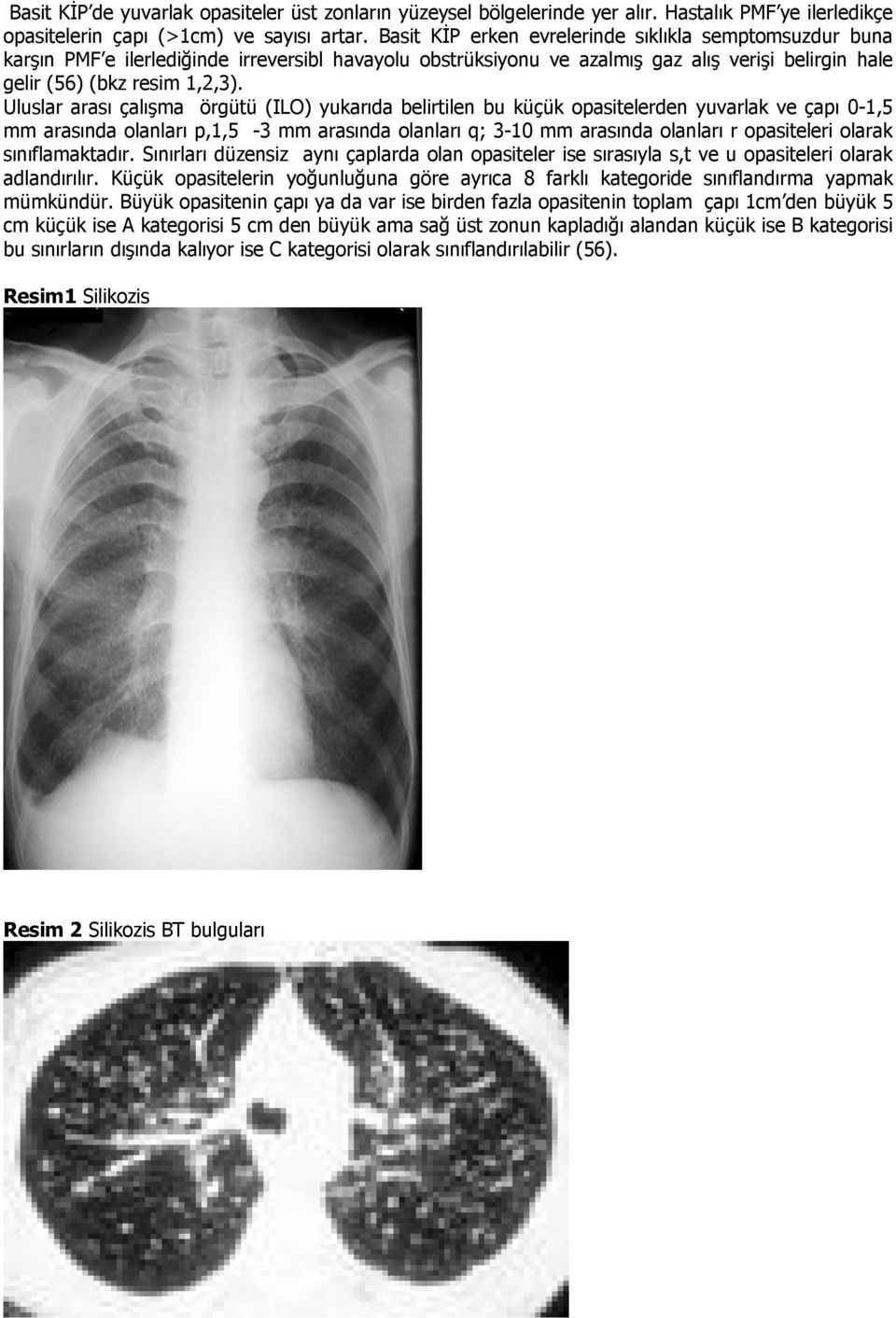 Uluslar arası çalışma örgütü (ILO) yukarıda belirtilen bu küçük opasitelerden yuvarlak ve çapı 0-1,5 mm arasında olanları p,1,5-3 mm arasında olanları q; 3-10 mm arasında olanları r opasiteleri