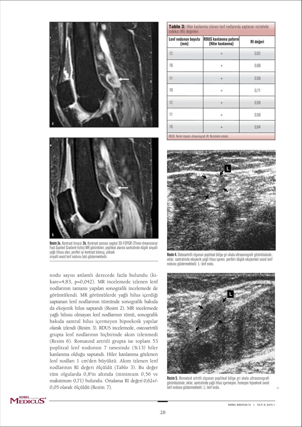 Kontrast sonrasý sagital D-FSPGR (Three-dimensional Fast Spoiled Gradient-Echo) MR görüntüleri, popliteal alanda santralinde düþük sinyalli yaðlý hilusu olan, periferi iyi kontrast tutmuþ, yüksek