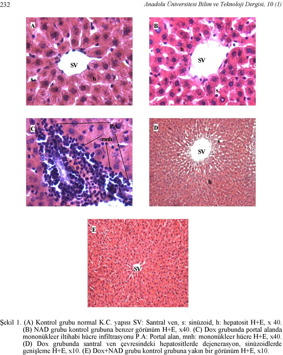 (B) NAD grubu kontrol grubuna benzer görünüm H+E, x40. (C) Dox grubunda portal alanda mononükleer iltihabi hücre infiltrasyonu P.
