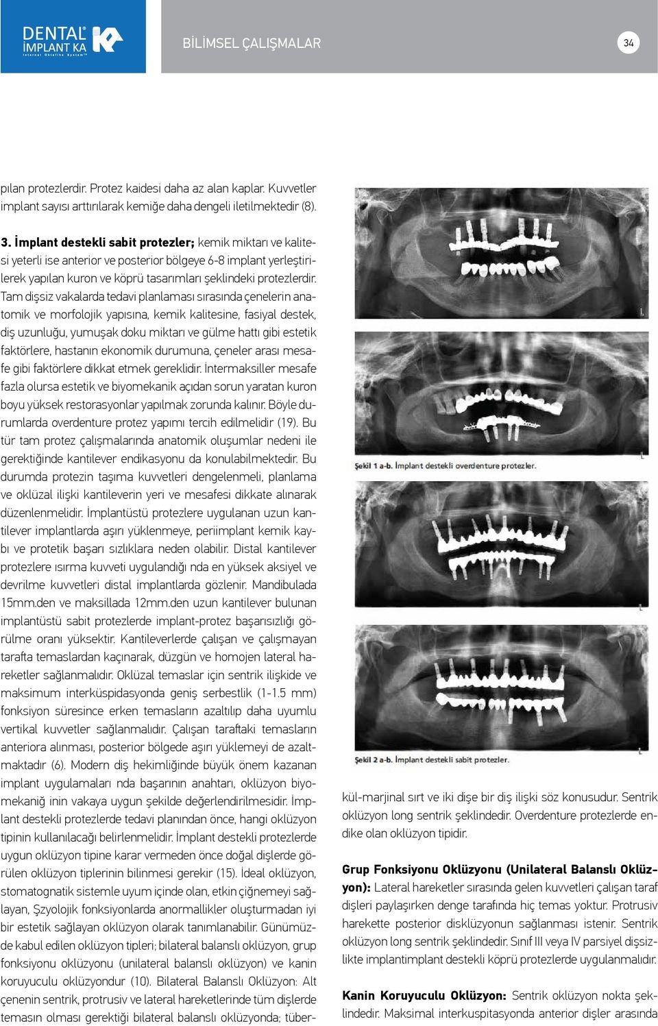 İmplant destekli sabit protezler; kemik miktarı ve kalitesi yeterli ise anterior ve posterior bölgeye 6-8 implant yerleştirilerek yapılan kuron ve köprü tasarımları şeklindeki protezlerdir.